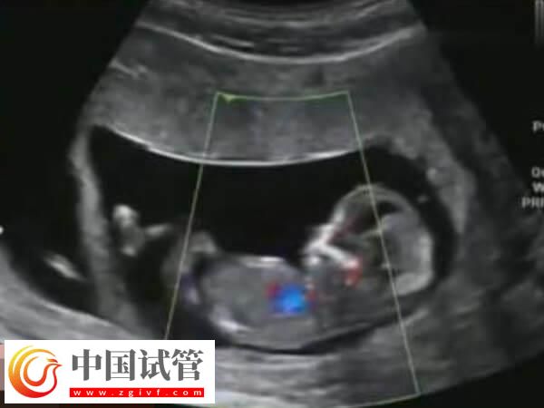 胚胎移植过后要注意这6点,饮食调理、定期产检都在其中(图2) 胚胎移植过后要注意这6点,饮食调理、定期产检都在其中(图2)