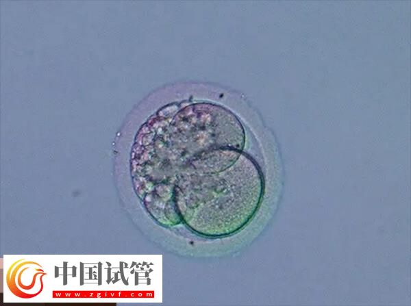 做试管月经不规律的移植方案分享，激素替代周期为其一(图2)