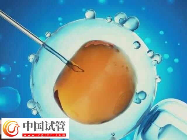 做试管月经不规律的移植方案分享，激素替代周期为其一(图1)