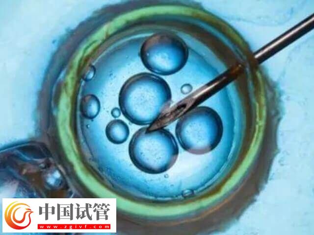 上海试管医院排名前十名