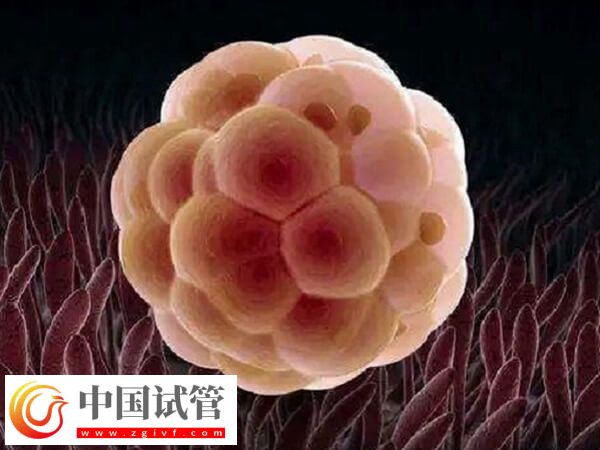 年龄大五个卵泡做几代试管(图1) 年龄大五个卵泡做几代试管(图1)