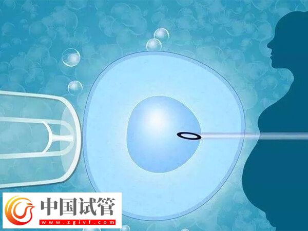 年龄大五个卵泡做几代试管(图2) 年龄大五个卵泡做几代试管(图2)