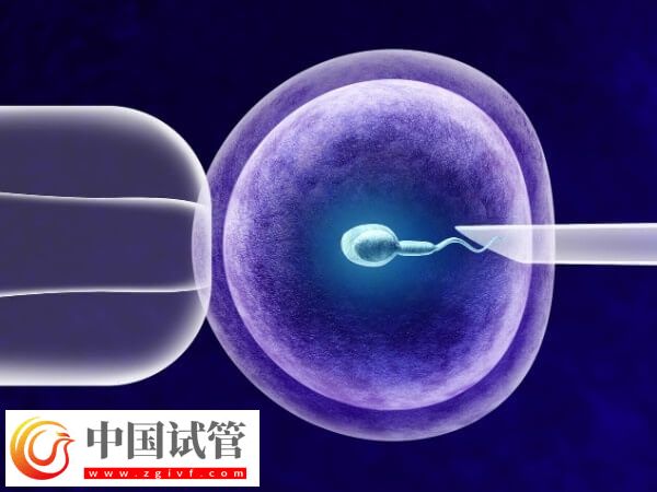 上海九院试管流程是什么