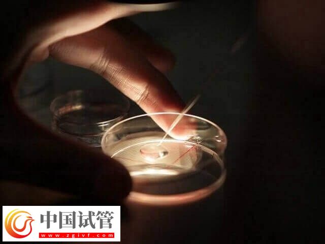 高龄是不是适合养囊胚(图2)