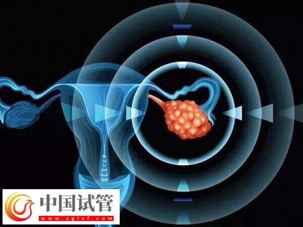 24岁卵巢早衰医生说不用治怎么回事(图1) 24岁卵巢早衰医生说不用治怎么回事(图1)