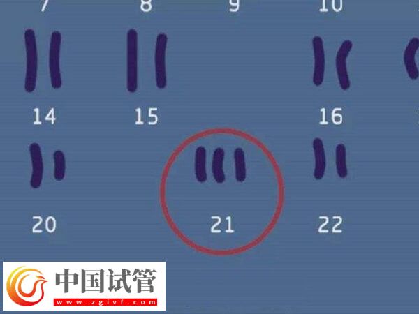 22号染色体异常还能不能要孩子(图2) 22号染色体异常还能不能要孩子(图1)