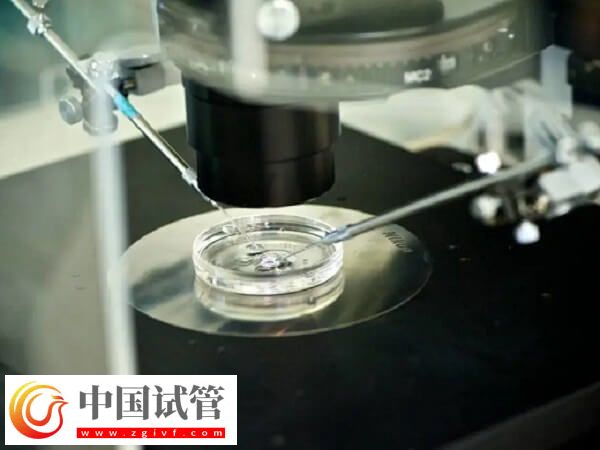 ivm和ivf哪个成功率高(图2)