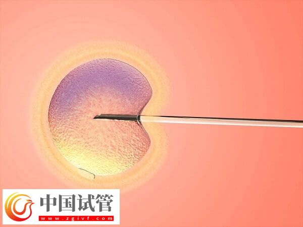 ivf和icsi哪个成功率高(图2)