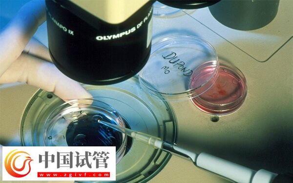 ivf和icsi的区别是什么(图2)