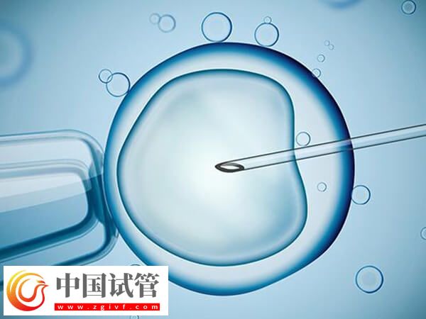 ivf和icsi的区别是什么(图1)