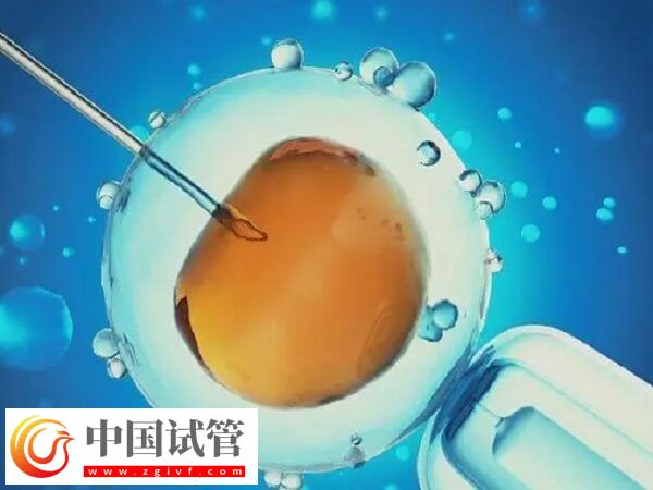 北京和上海做试管哪个技术好