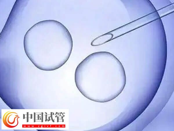 广州能不能做HIV试管