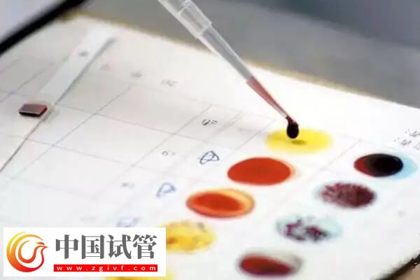 关节挛缩做试管有没有影响(图2)