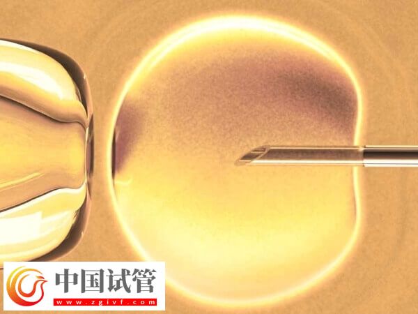 做试管促排卵要注意什么(图1)