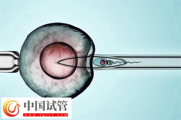 试管婴儿改良长方案促排卵有哪些优缺点？(图1)