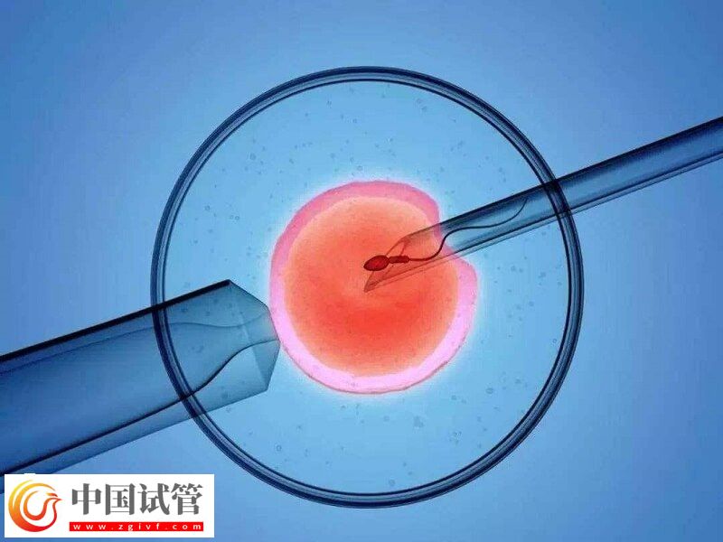 人工授精跟试管婴儿有什么区别