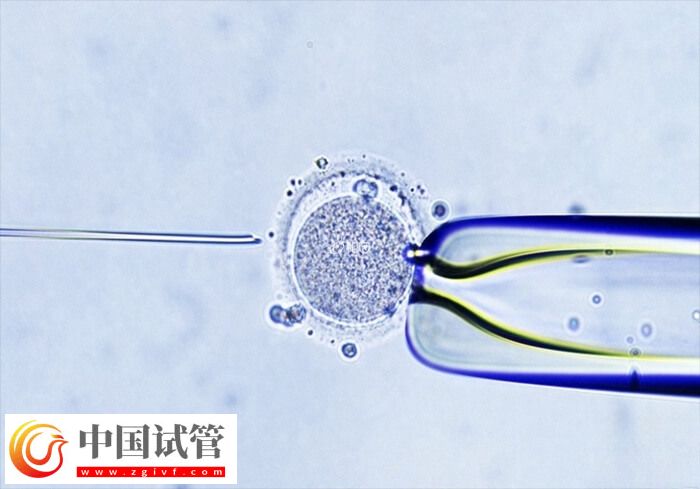 试管婴儿助孕有几个阶段(图1)