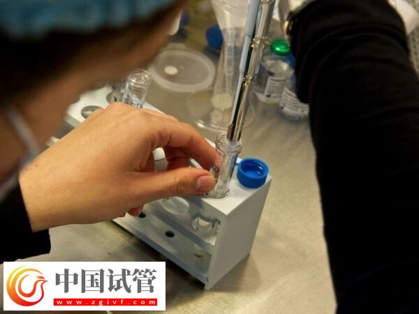 取完卵后如何判定腹水(图1)