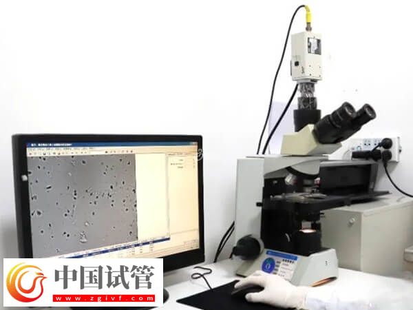 试管婴儿精液检查都有什么项目(图2)