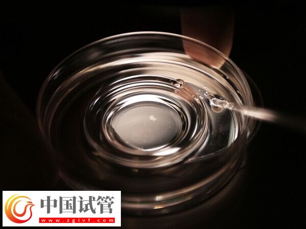 第四代试管婴儿适不适合大龄女性