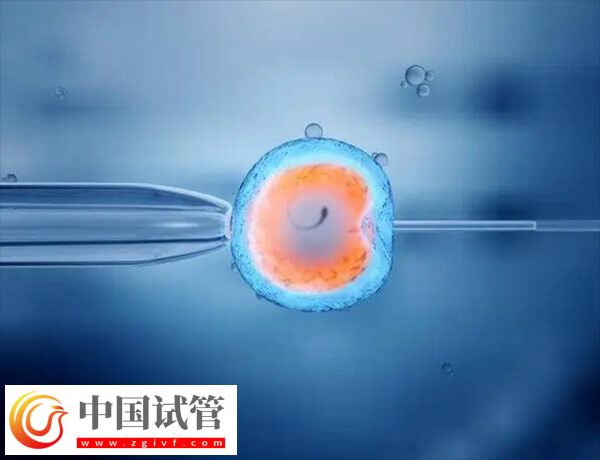 北京协和医院做试管要什么证件(图2)