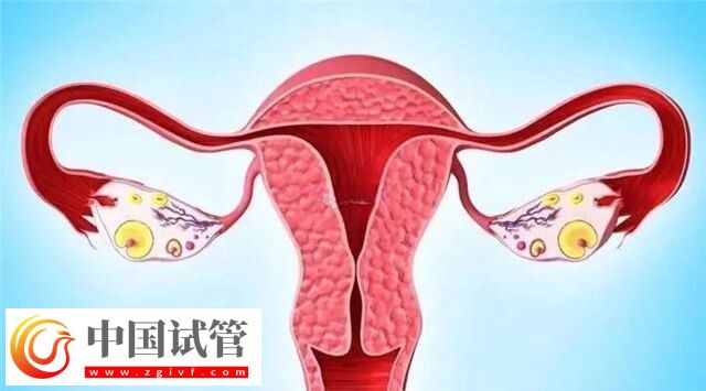 导致女性出现宫外孕的原因有哪些(图2)