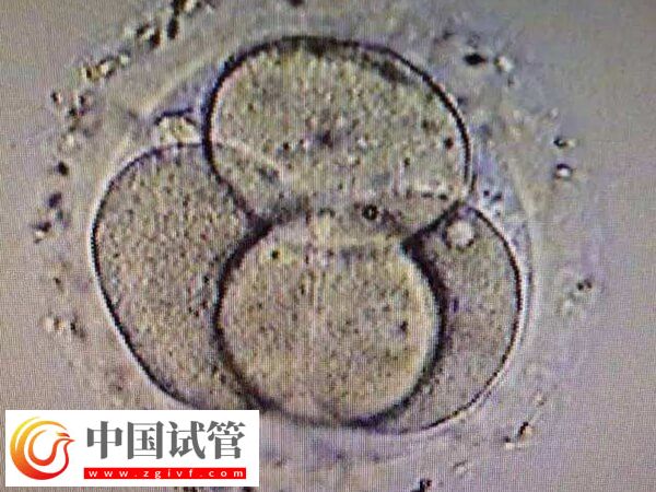 试管婴儿移植失败是怎么回事