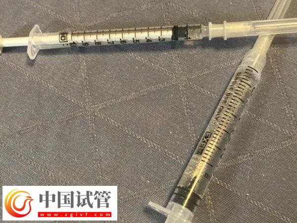 试管长方案珍怡的作用有哪些(图2) 试管长方案珍怡的作用有哪些(图2)