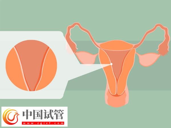 子宫内膜4mm是怎么回事