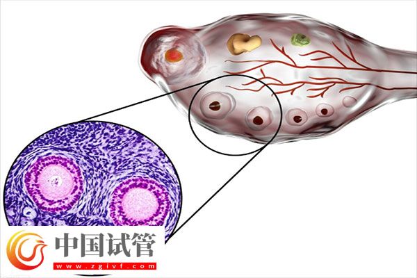 试管婴儿促排期间注意事项有哪些呢？